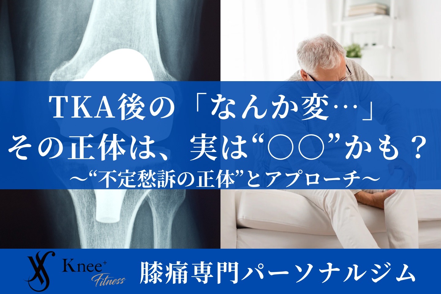 人工膝関節全置換術（TKA）後の不定愁訴に対する評価と実践的アプローチ