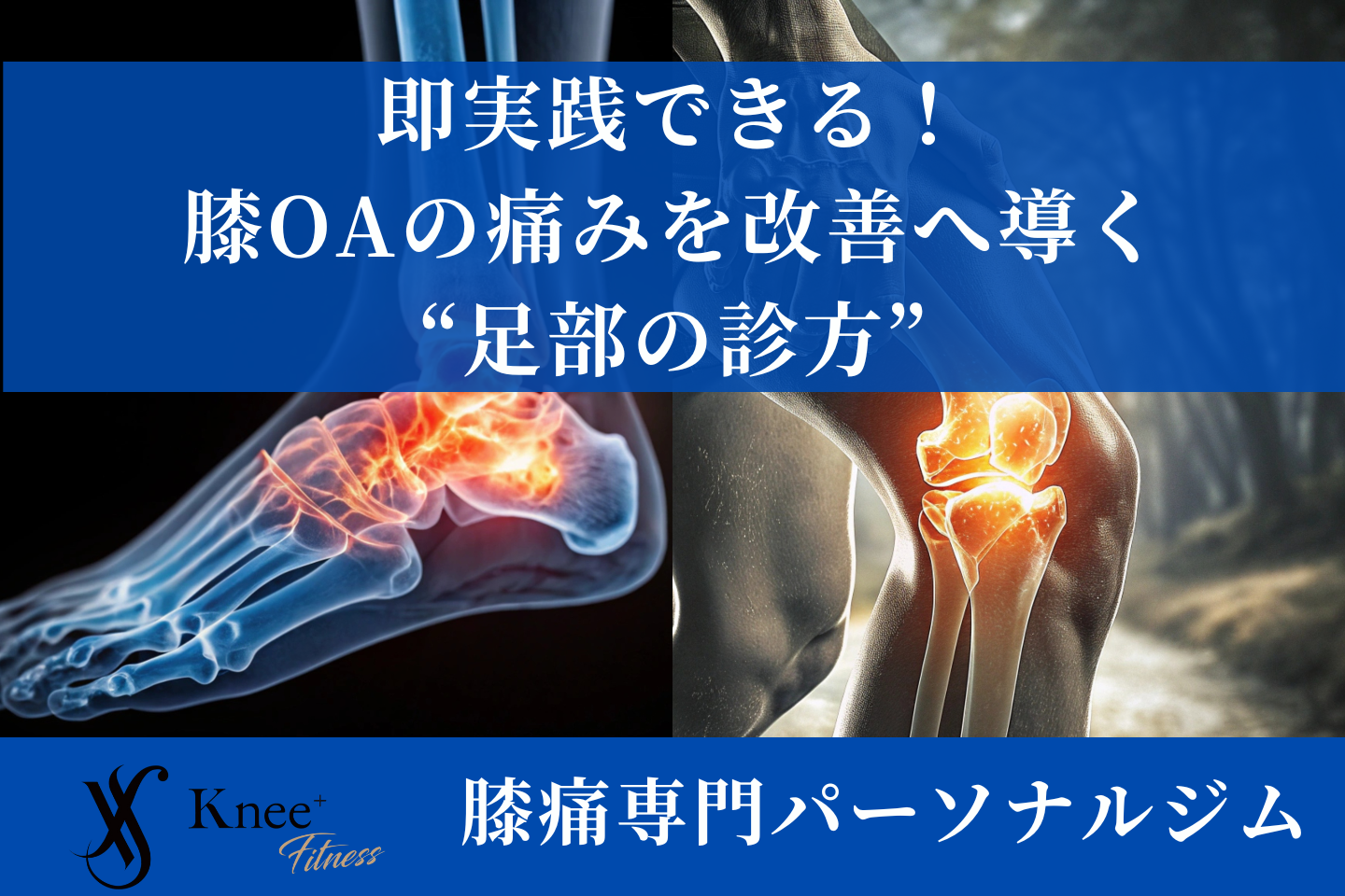即実践できる!膝OAの痛みを改善へ導く“足部の診方”