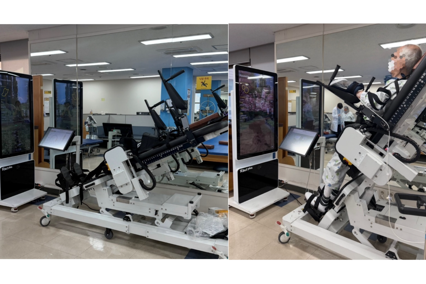 起立位ロボット歩行訓練、脳卒中の歩行自立度を改善　通常リハ上乗せで3か月維持