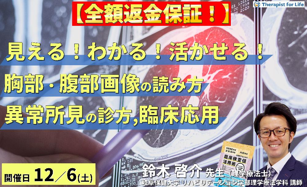 【全額返金保証付き】PT・OT・STのための「見える！わかる！活かせる！胸部・腹部画像の読み方」 ～異常所見の診方とリハビリへの応用～　講師：鈴木啓介先生