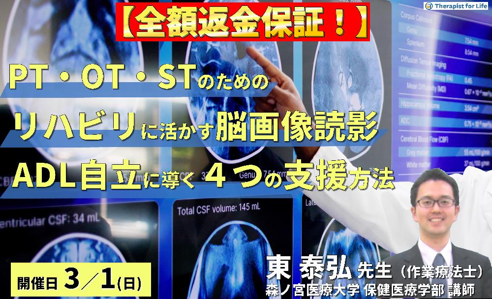 【全額返金保証付き】（全２回）PT・OT・STのためのリハビリに活かす脳画像読影～「どこができなくて何が原因か」を読み解き、ADL自立へ導く４つの支援方法～　講師：東泰弘先生