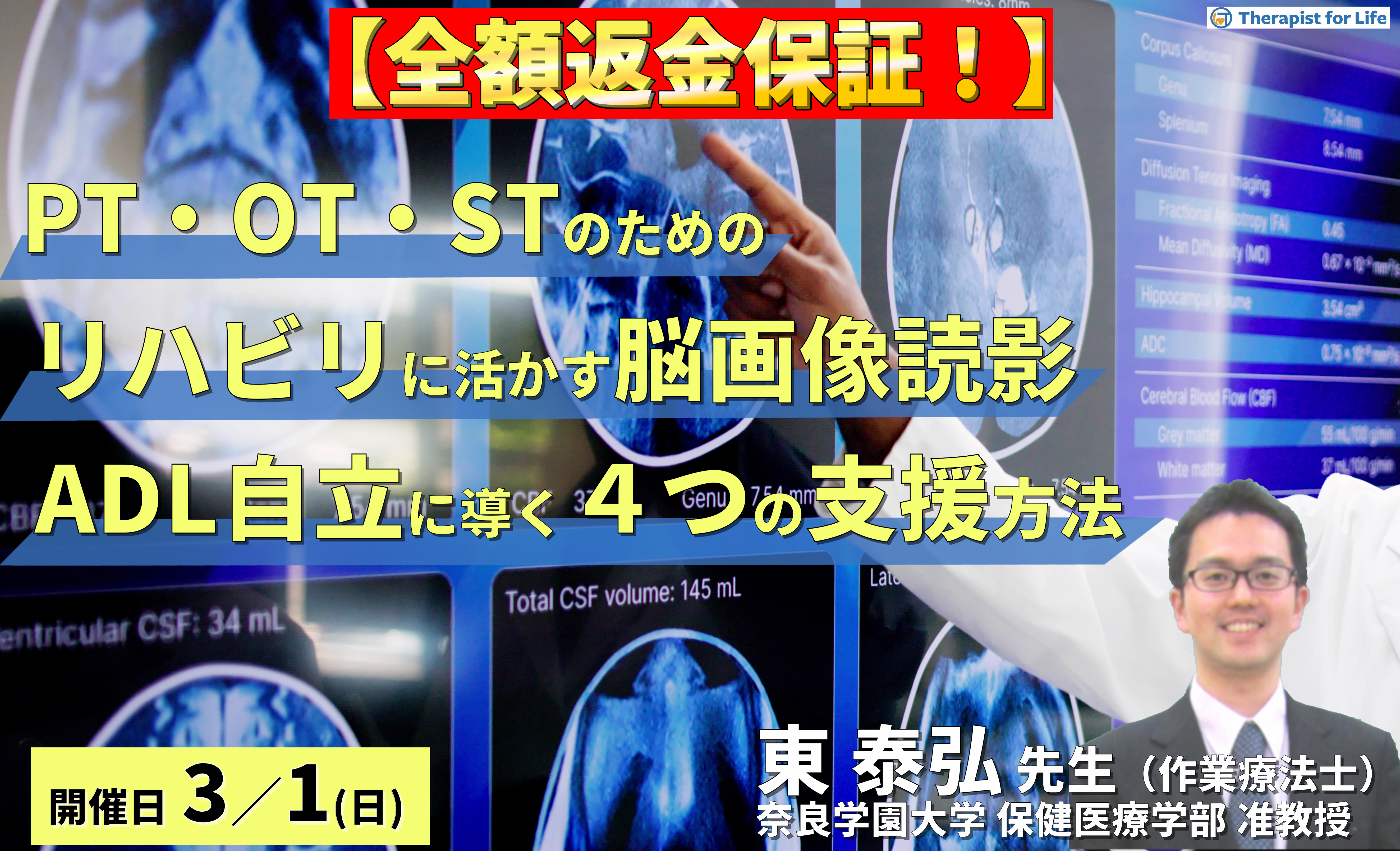 【全額返金保証付き】（全２回）PT・OT・STのためのリハビリに活かす脳画像読影～「どこができなくて何が原因か」を読み解き、ADL自立へ導く４つの支援方法～　講師：東泰弘先生