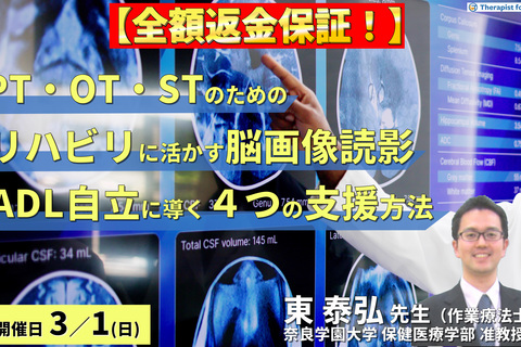 【全額返金保証付き】（全２回）PT・OT・STのためのリハビリに活かす脳画像読影～「どこができなくて何が原因か」を読み解き、ADL自立へ導く４つの支援方法～　講師：東泰弘先生