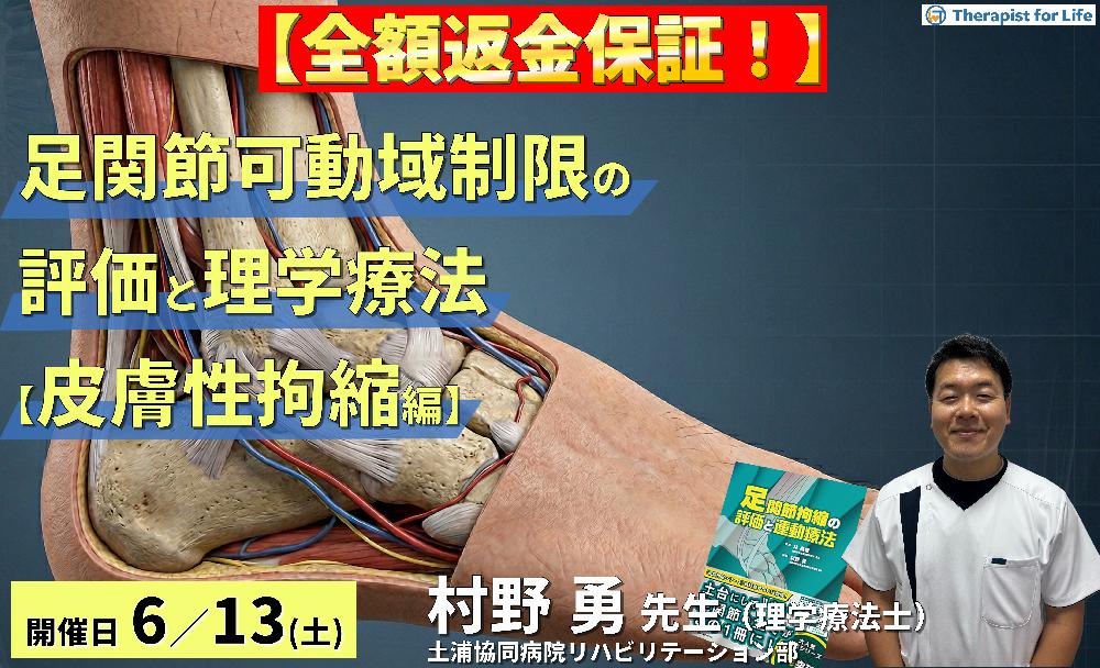 ※全額返金保証付き【皮膚性拘縮編】足関節可動域制限の評価と運動療法~皮膚性・筋性拘縮の鑑別とエコー・触診による臨床介入~ 講師:村野勇先生