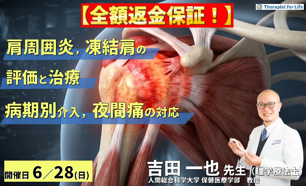 【早割中！】肩関節周囲炎・凍結肩の評価と治療〜病期で変わるアプローチと夜間痛への対応〜　講師：吉田一也先生